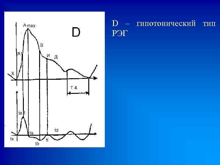 D – гипотонический тип РЭГ 