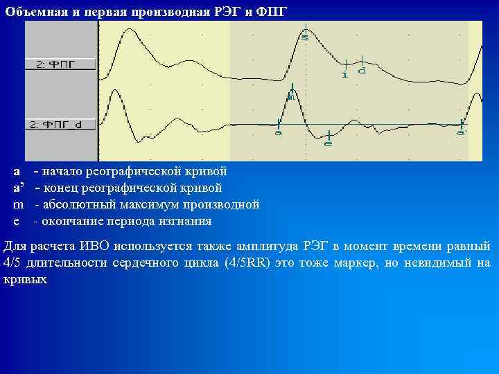 Объемная и первая производная РЭГ и ФПГ a - начало реографической кривой a’ -