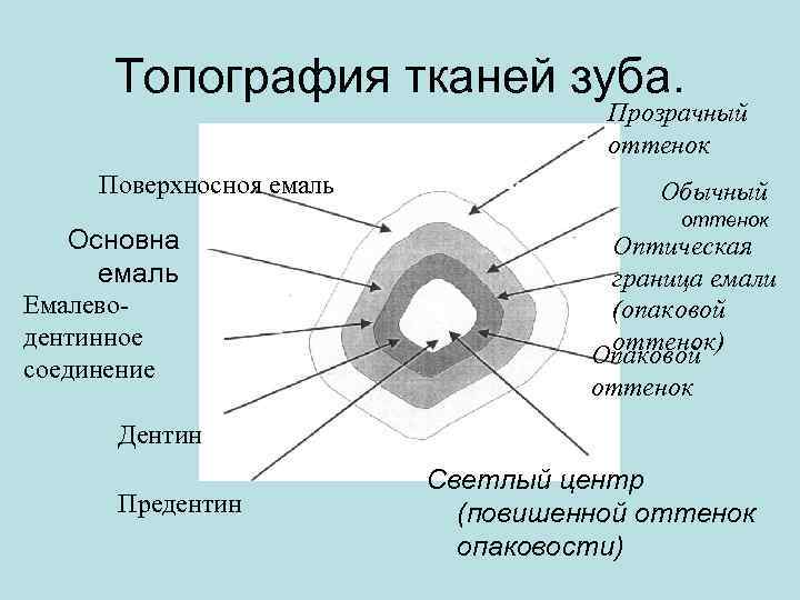 Топография тканей зуба. Прозрачный оттенок Поверхносноя емаль Основна емаль Емалеводентинное соединение Обычный оттенок Оптическая