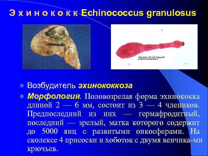 Э х и н о к к Echinococcus granulosus Возбудитель эхинококкоза l Морфология. Половозрелая