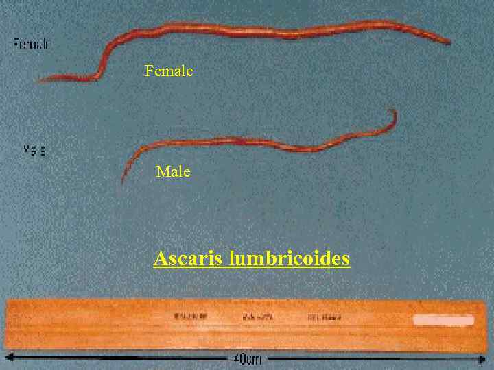 Female Male Ascaris lumbricoides 
