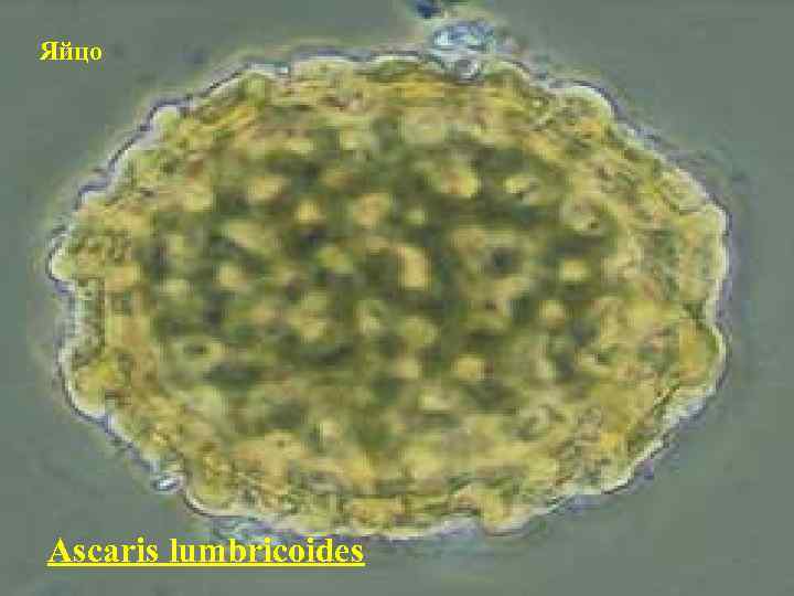 Яйцо Ascaris lumbricoides 