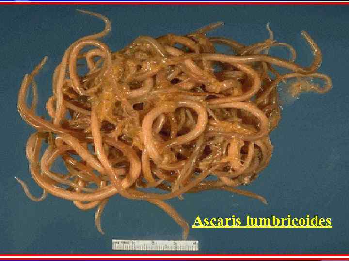 Ascaris lumbricoides 