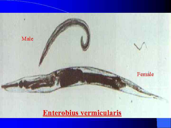 Male Female Enterobius vermicularis 