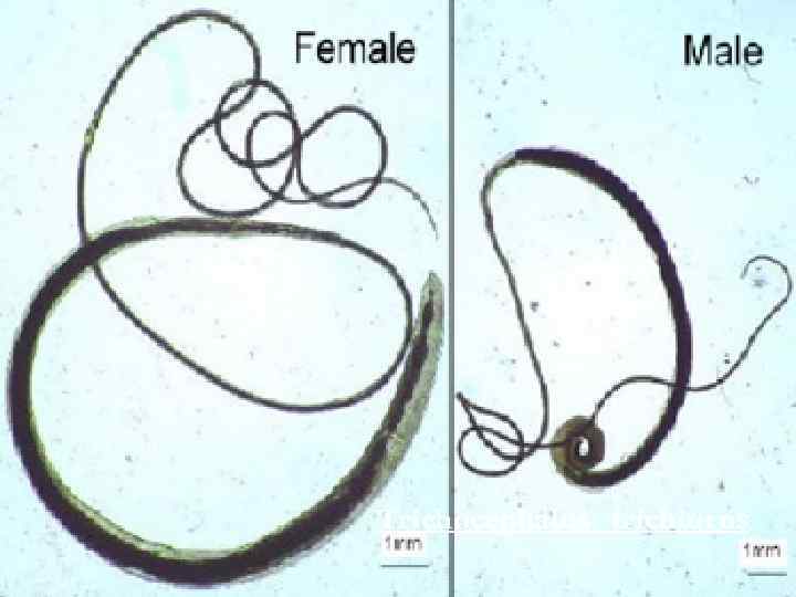 Trichocephalus trichiurus 