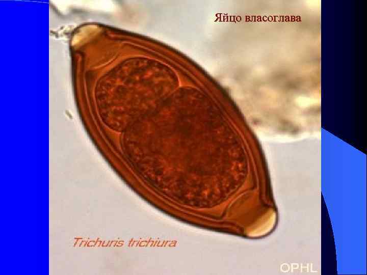 Яйцо власоглава 