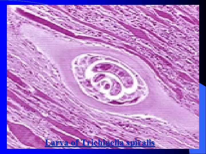 Larva of Trichinella spiralis 