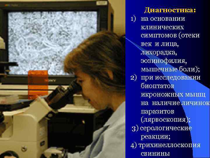 Диагностика: 1) на основании клинических симптомов (отеки век и лица, лихорадка, эозинофилия, мышечные боли);