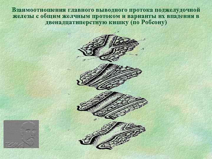 Взаимоотношения главного выводного протока поджелудочной железы с общим желчным протоком и варианты их впадения