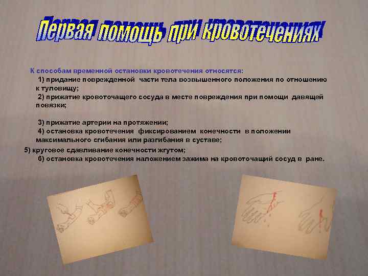  К способам временной остановки кровотечения относятся: 1) придание поврежденной части тела возвышенного положения
