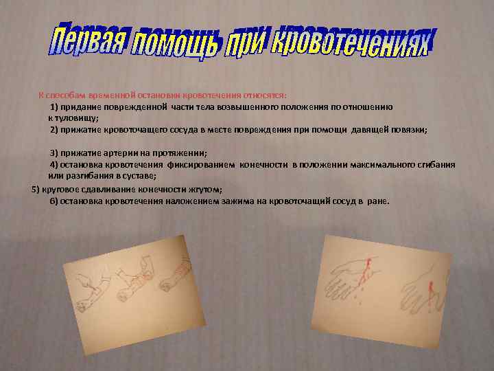  К способам временной остановки кровотечения относятся: 1) придание поврежденной части тела возвышенного положения