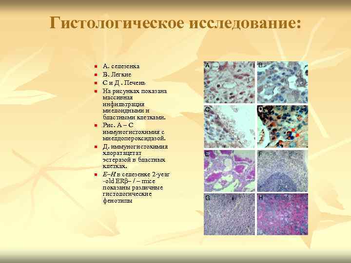 Гистологическое исследование: n n n n А. селезенка В. Легкие С и Д. Печень