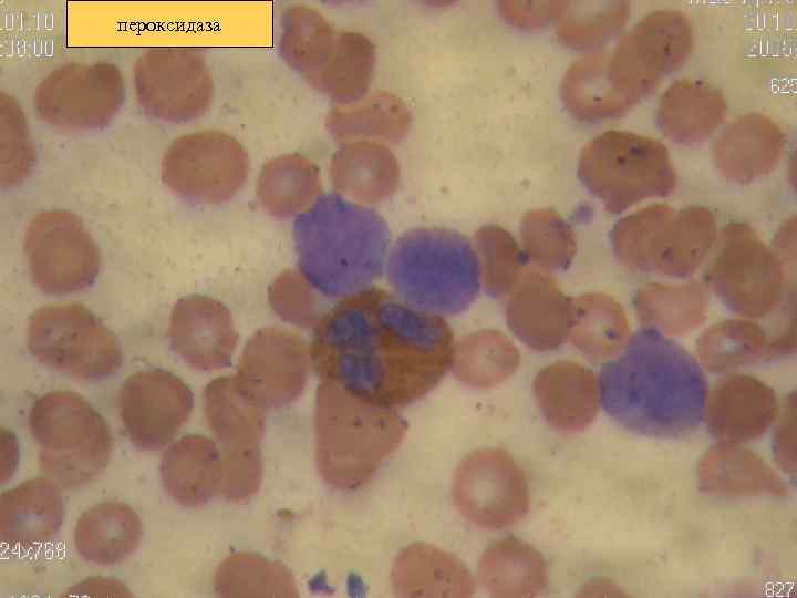 пероксидаза 