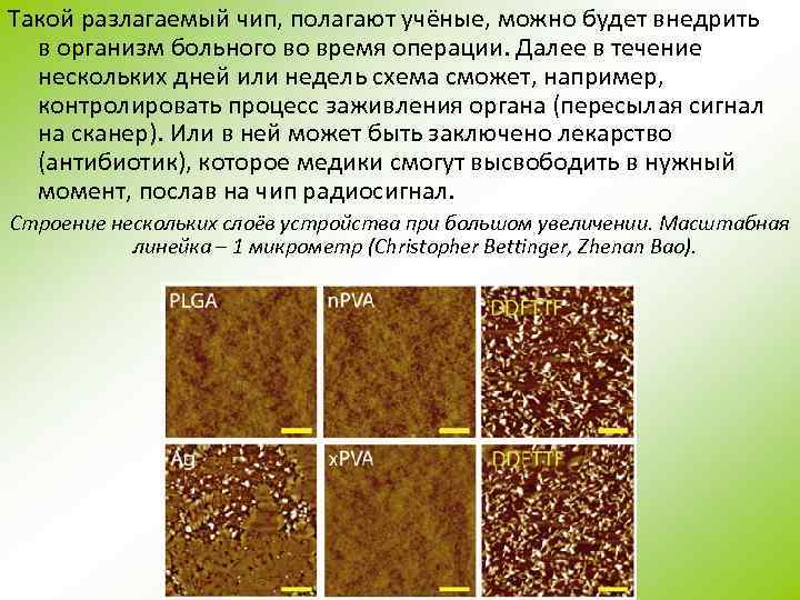 Такой разлагаемый чип, полагают учёные, можно будет внедрить в организм больного во время операции.