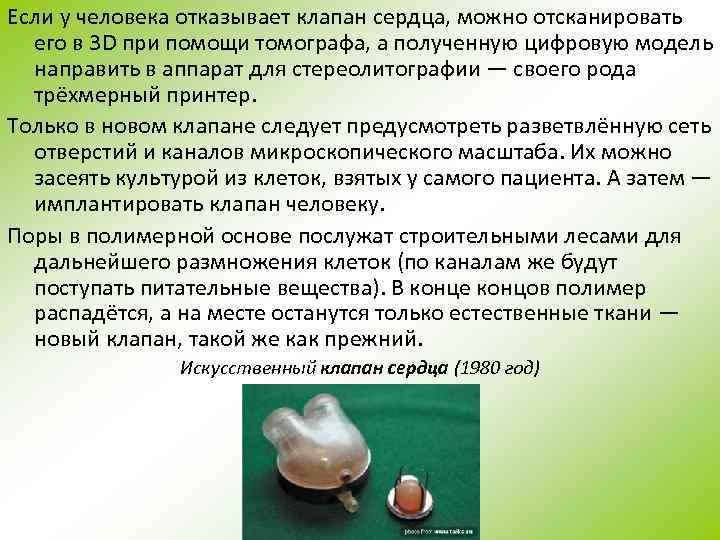 Если у человека отказывает клапан сердца, можно отсканировать его в 3 D при помощи