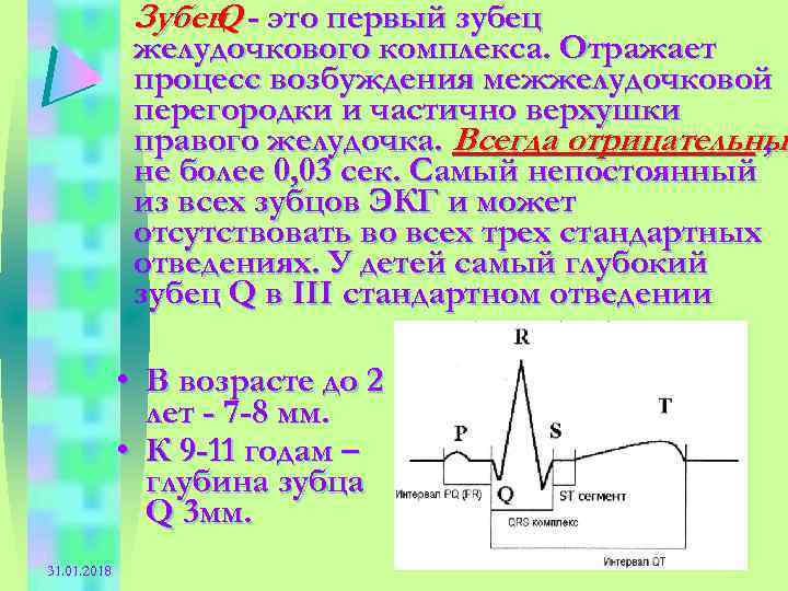 Инверсия зубца это