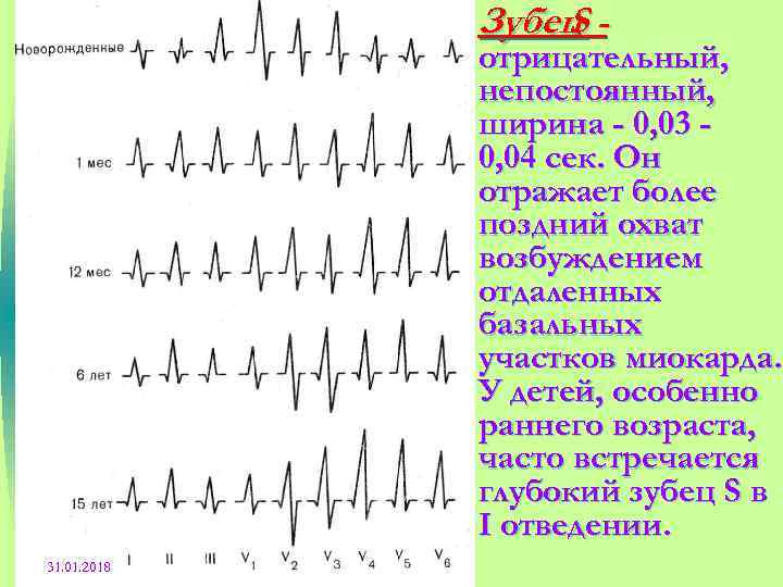  • Зубец S отрицательный, непостоянный, ширина - 0, 03 0, 04 сек. Он