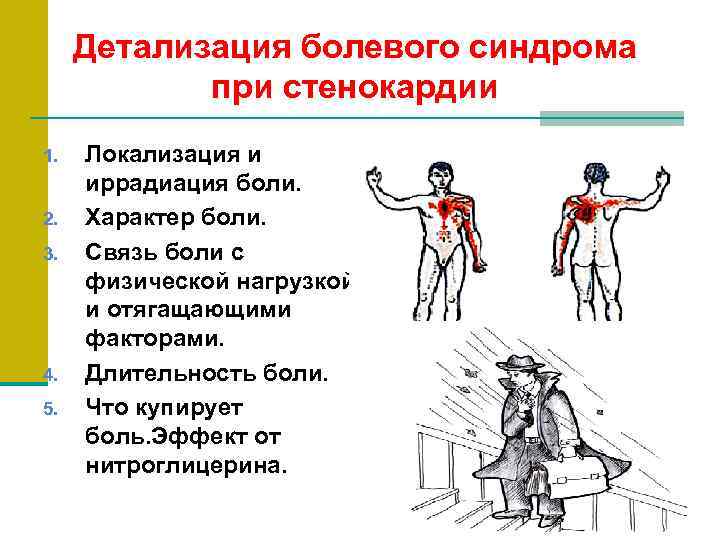 Детализация болевого синдрома при стенокардии 1. 2. 3. 4. 5. Локализация и иррадиация боли.