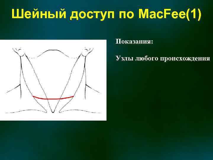 Шейный доступ по Mac. Fee(1) Показания: Узлы любого происхождения 