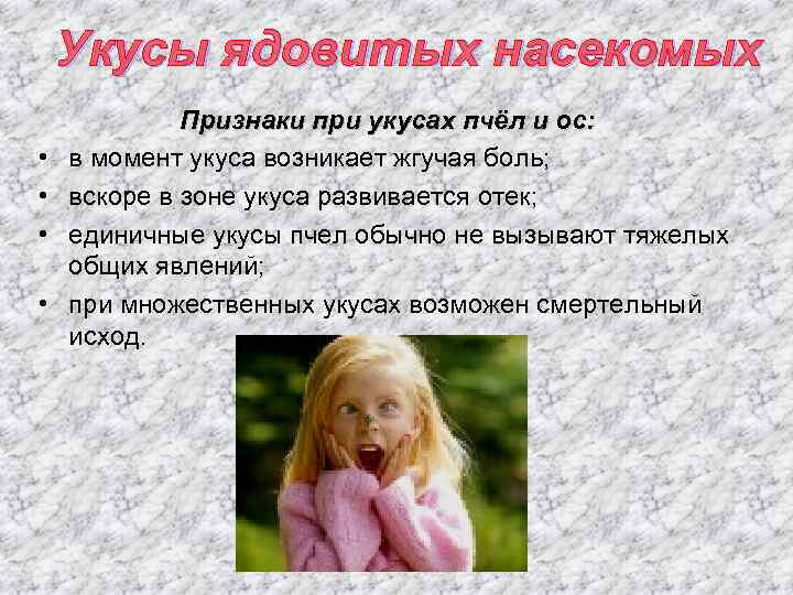 Укусы ядовитых насекомых • • Признаки при укусах пчёл и ос: в момент укуса