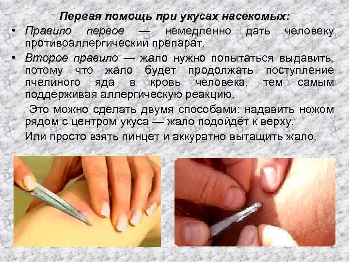  • • Первая помощь при укусах насекомых: Правило первое — немедленно дать человеку