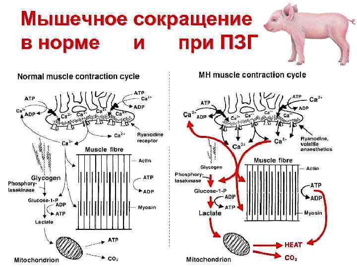 Мышечное сокращение в норме и при ПЗГ 