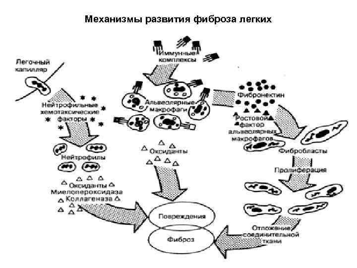 Механизмы развития фиброза легких 