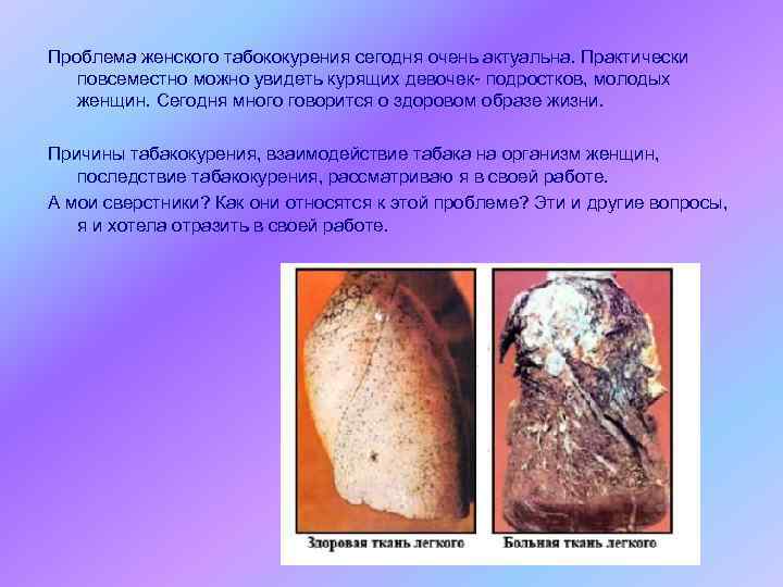 Проблема женского табококурения сегодня очень актуальна. Практически повсеместно можно увидеть курящих девочек- подростков, молодых