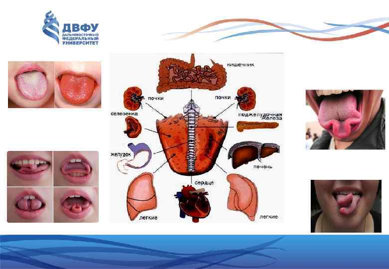 оценка качества пищи за счет рецепторов: общей (болевой, температурной) чувствительности (конические и нитевидные сосочки)