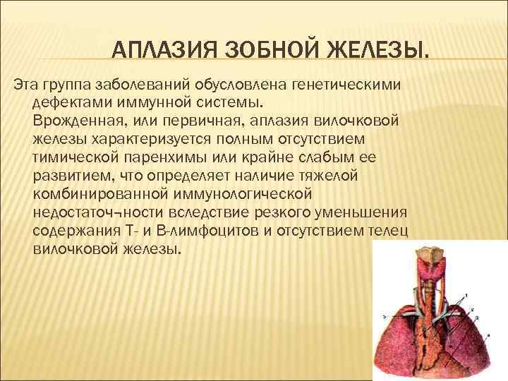 АПЛАЗИЯ ЗОБНОЙ ЖЕЛЕЗЫ. Эта группа заболеваний обусловлена генетическими дефектами иммунной системы. Врожденная, или первичная,