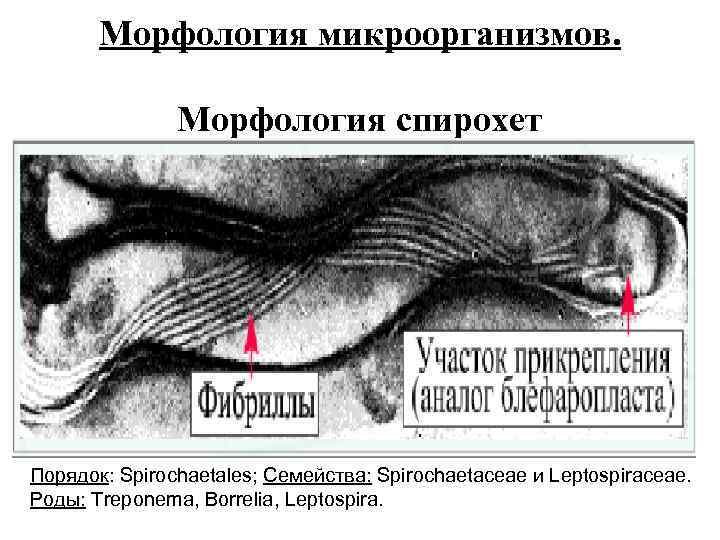 Морфология микроорганизмов. Морфология спирохет Порядок: Spirochaetales; Семейства: Spirochaetaceae и Leptospiraceae. Роды: Treponema, Borrelia, Leptospira.