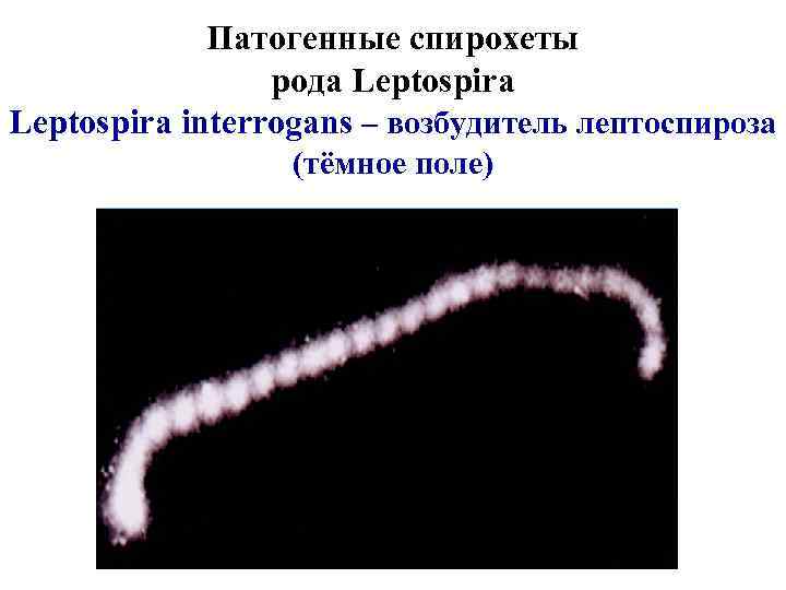 Патогенные спирохеты рода Leptospira interrogans – возбудитель лептоспироза (тёмное поле) 