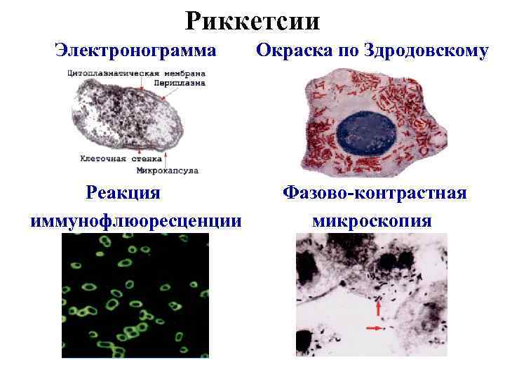 Риккетсии Электронограмма Окраска по Здродовскому Реакция иммунофлюоресценции Фазово-контрастная микроскопия 