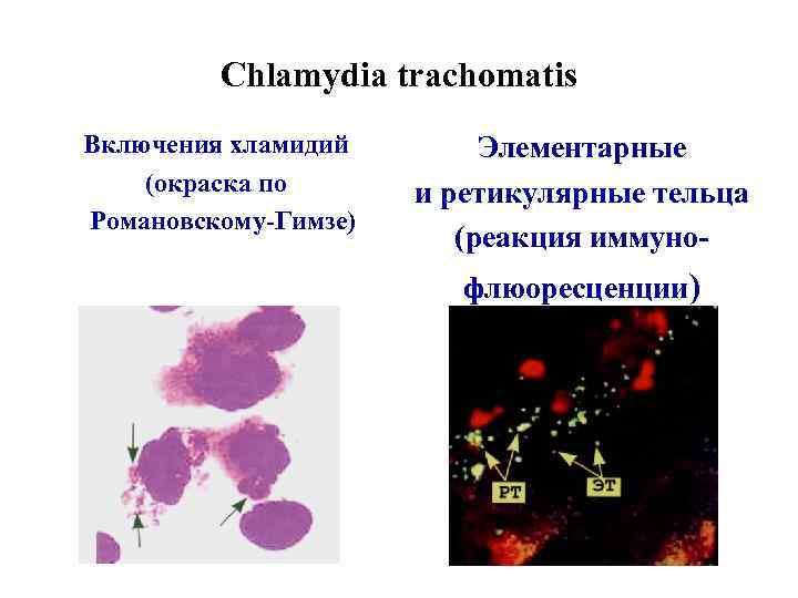 Chlamydia trachomatis Включения хламидий (окраска по Романовскому-Гимзе) Элементарные и ретикулярные тельца (реакция иммунофлюоресценции) 