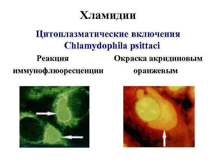 Хламидии Цитоплазматические включения Chlamydophila psittaci Реакция иммунофлюоресценции Окраска акридиновым оранжевым 