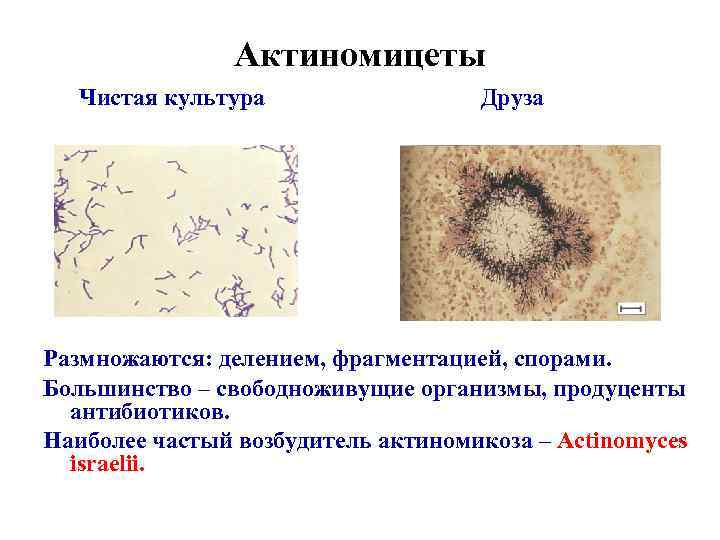 Актиномицеты Чистая культура Друза Размножаются: делением, фрагментацией, спорами. Большинство – свободноживущие организмы, продуценты антибиотиков.