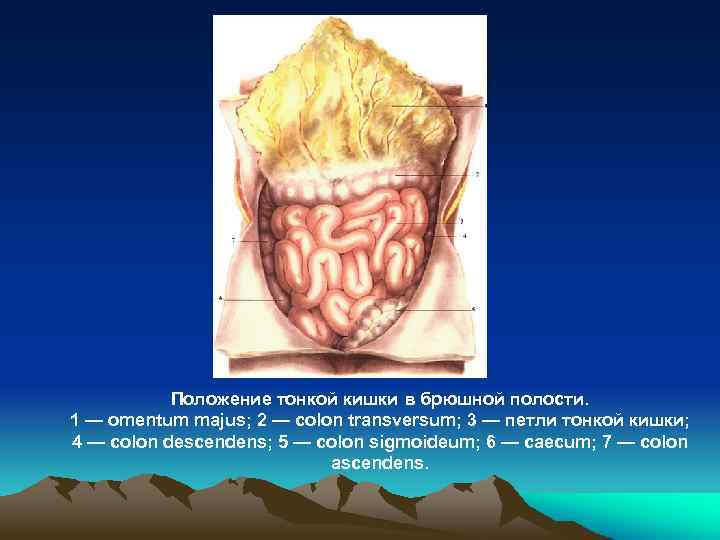 Положение тонкой кишки в брюшной полости. 1 — omentum majus; 2 — colon transversum;