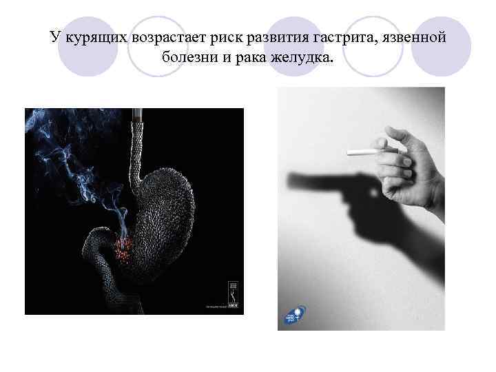 У курящих возрастает риск развития гастрита, язвенной болезни и рака желудка. 