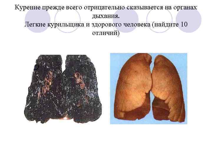 Курение прежде всего отрицательно сказывается на органах дыхания. Легкие курильщика и здорового человека (найдите