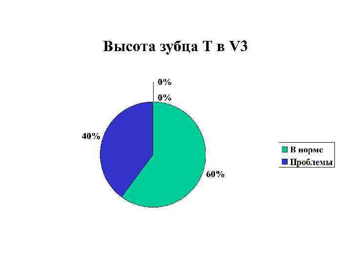 Высота зубца Т в V 3 