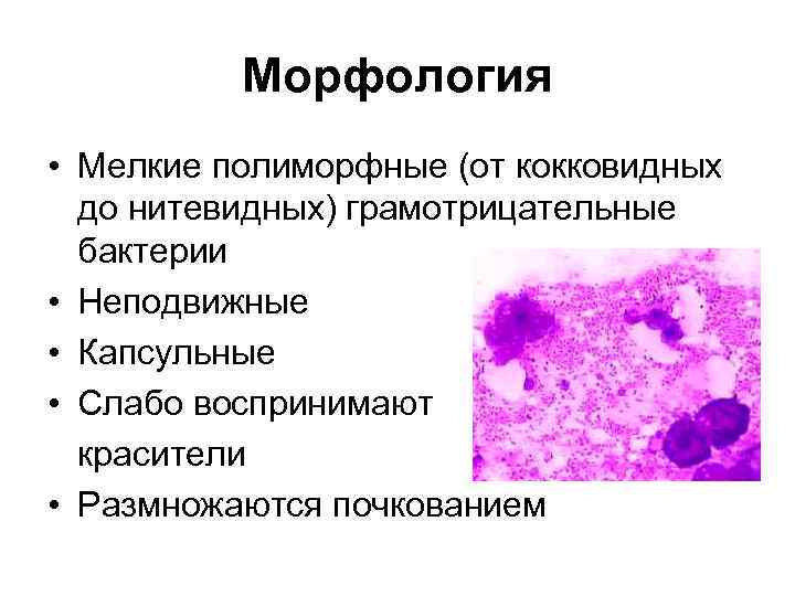 Презентация на тему особо опасные инфекции