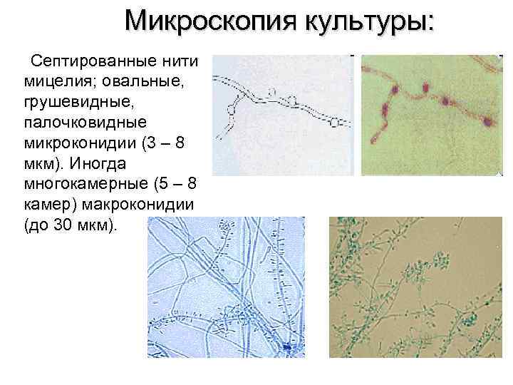 Споры гриба и нити. Мицелий гриба микроскопия. Мицелий грибов микроскопия. Мицелий грибов кожи микроскопия. Mucorales микроскопия мицелия.