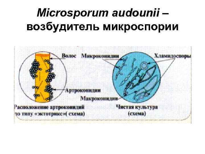 Microsporum canis возбудитель. Методы диагностики микроспории. Споры погибают при температуре