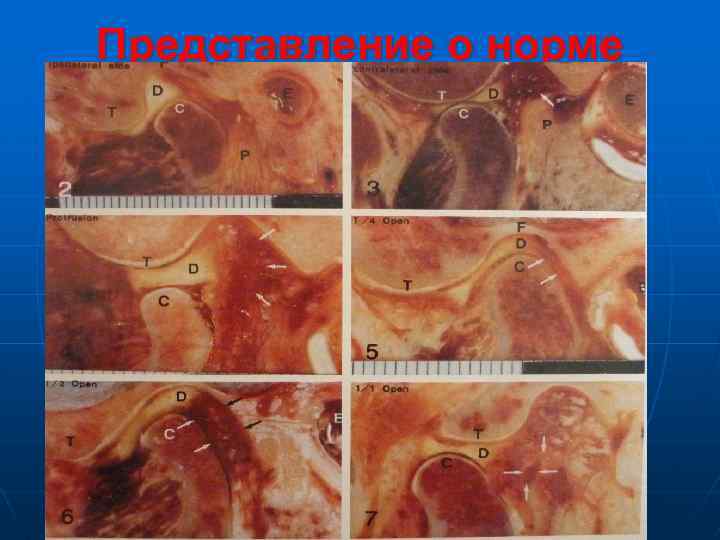 Представление о норме 