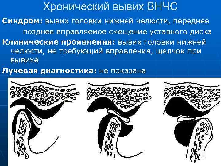 Лучевая диагностика внчс презентация