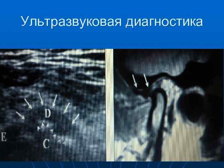 Ультразвуковая диагностика 