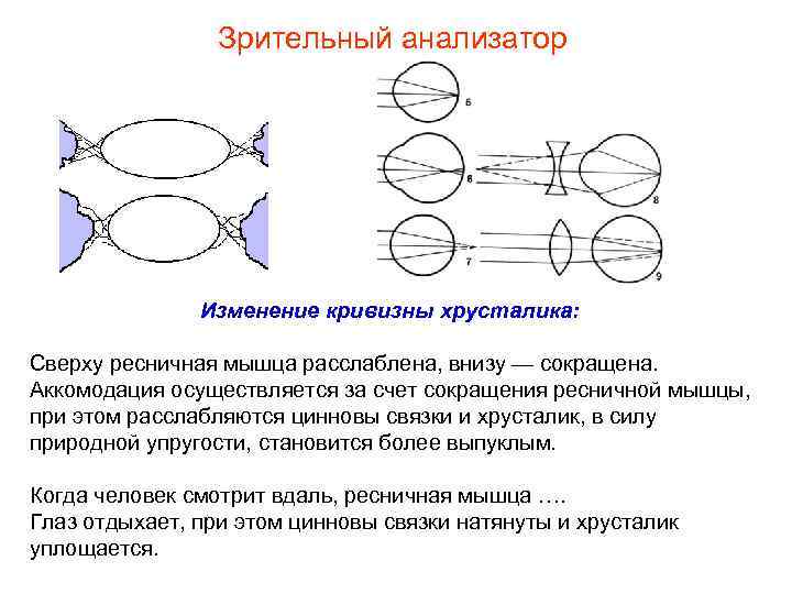 Зрительный анализатор Изменение кривизны хрусталика: Cверху ресничная мышца расслаблена, внизу — сокращена. Аккомодация осуществляется