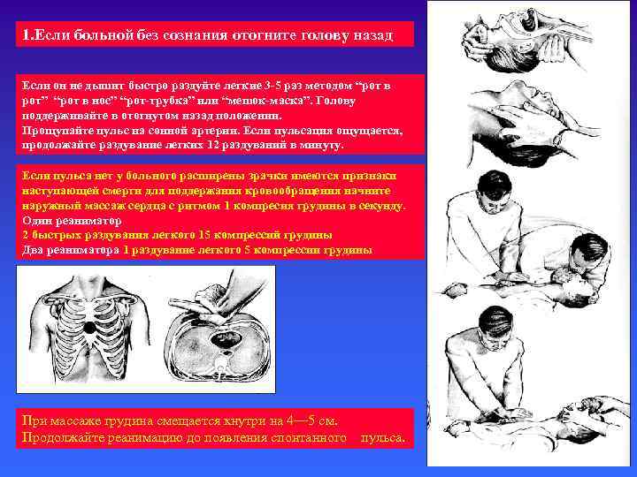 1. Если больной без сознания отогните голову назад Если он не дышит быстро раздуйте