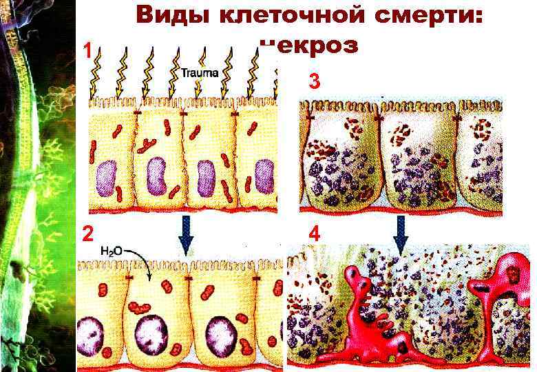 1 Виды клеточной смерти: некроз 3 2 4 27 