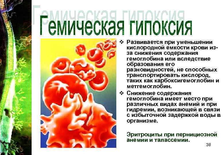 v Развивается при уменьшении кислородной емкости крови изза снижения содержания гемоглобина или вследствие образования